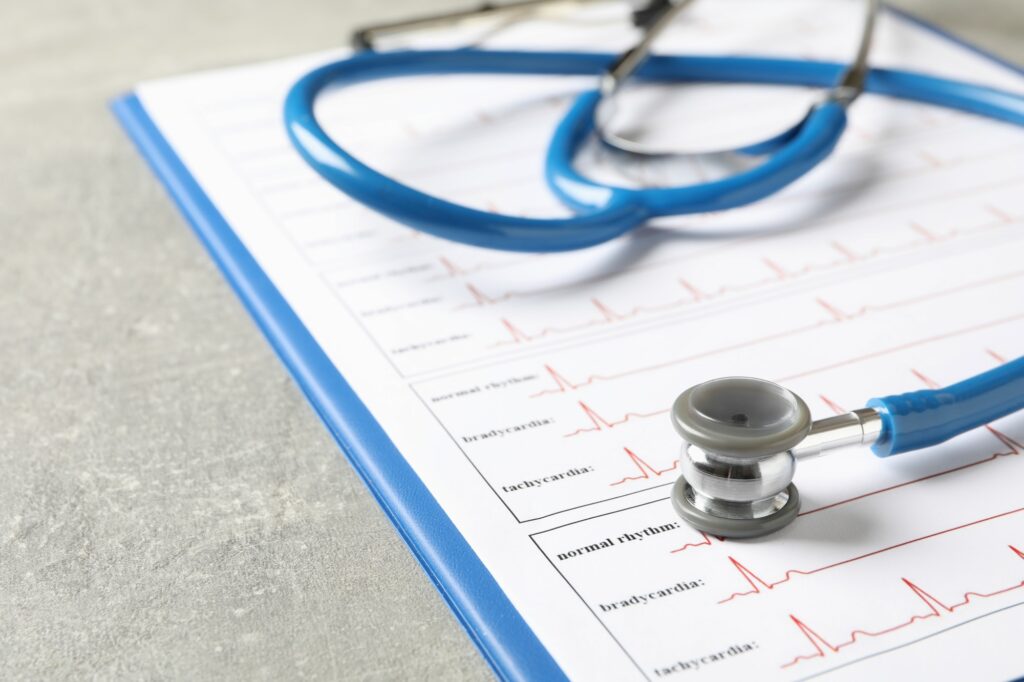 Stethoscope and clipboard with electrocardiogram on gray background